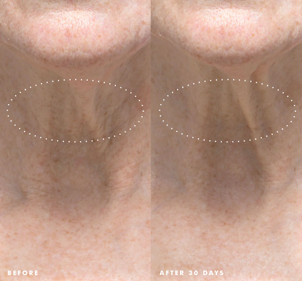 Necks-Level Smooth™ - Image 4