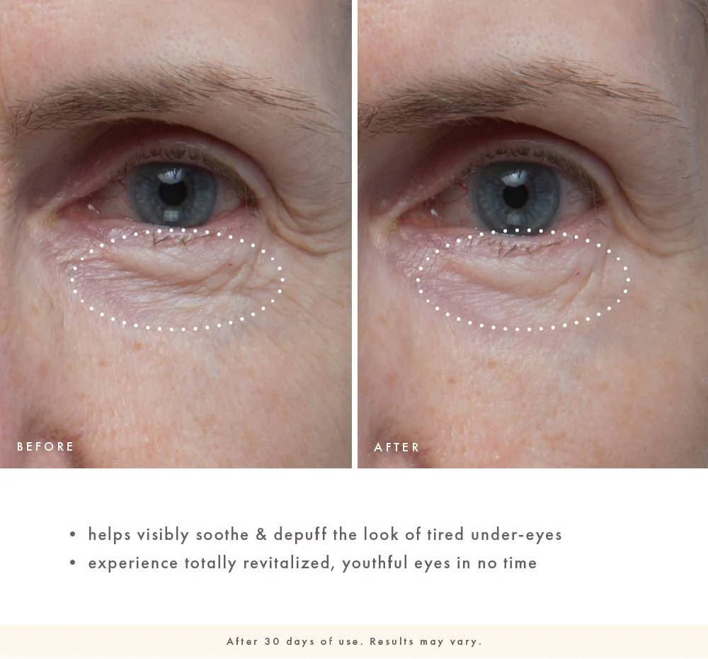 Firm-Tastic® Eyes - Image 5