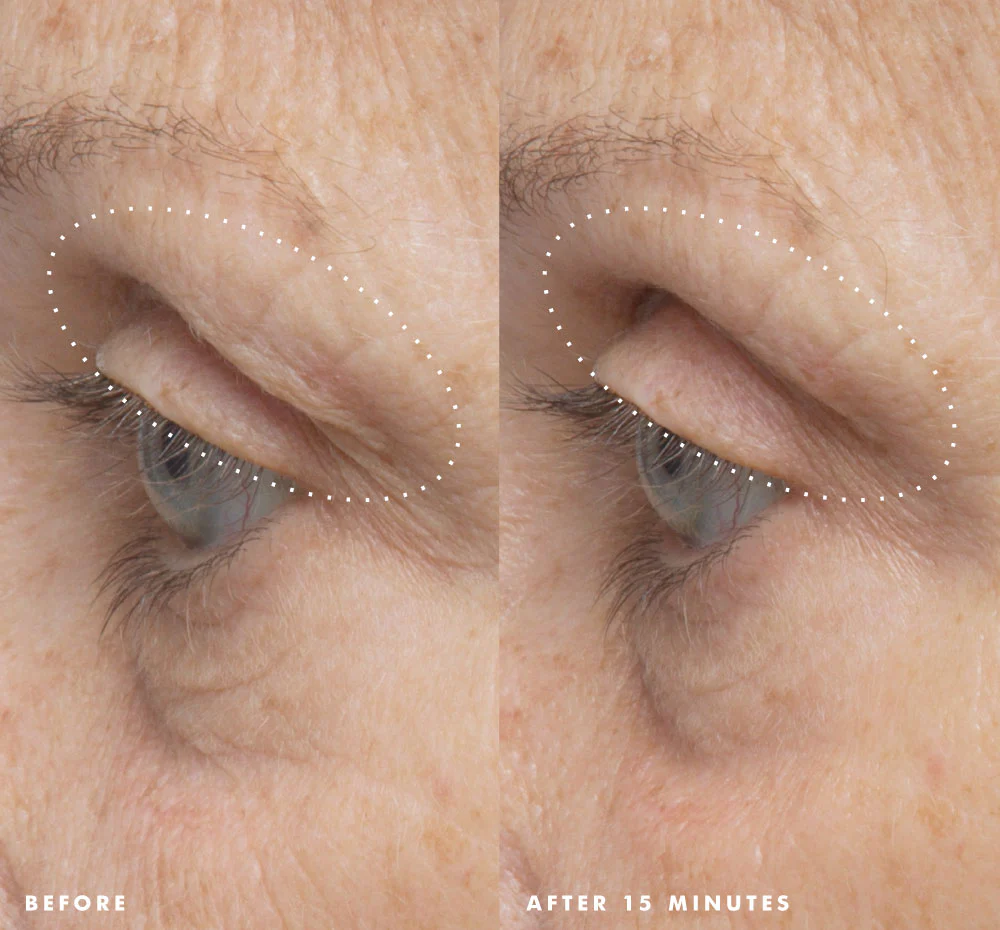 Firm-Tastic® Eyes - Image 8